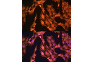 Immunofluorescence analysis of C6 cells using L Rabbit pAb (ABIN1680664, ABIN3018314, ABIN3018315 and ABIN6220434) at dilution of 1:100 (40x lens).