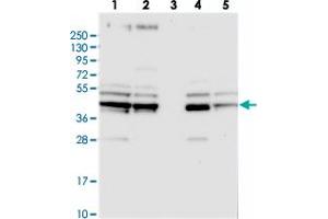 Western blot analysis of Lane 1: RT-4, Lane 2: U-251 MG, Lane 3: Human Plasma, Lane 4: Liver, Lane 5: Tonsil with SUCLA2 polyclonal antibody . (SUCLA2 anticorps)