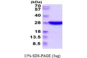 SDS-PAGE (SDS) image for Ubiquitin Carboxyl-terminal Esterase L3 (Ubiquitin Thiolesterase) (Uchl3) (AA 1-230) (Active) protein (His tag) (ABIN6387863)