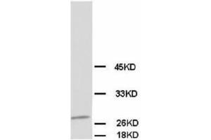 Image no. 1 for anti-Calbindin (CALB1) antibody (ABIN1502005) (CALB1 anticorps)