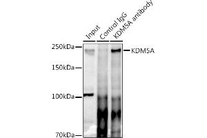 Immunoprecipitation analysis of 300 μg extracts of HeLa cells using 3 μg KDM5A antibody (ABIN6131816, ABIN6142800, ABIN6142801 and ABIN6223074).