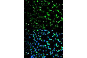 Immunofluorescence analysis of HeLa cell using TYMP antibody.