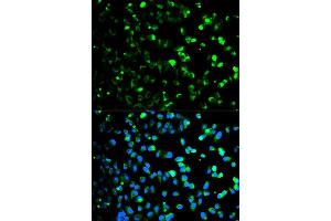 Immunofluorescence analysis of HeLa cell using TYMP antibody. (Thymidine Phosphorylase anticorps  (AA 1-200))