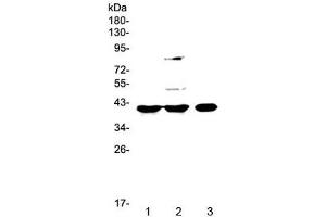 Western blot testing of 1) rat spleen, 2) rat liver and 3) mouse testis lysate with PPID antibody at 0. (PPID anticorps)
