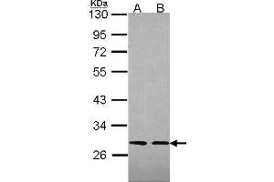 WB Image Sample (30 ug of whole cell lysate) A: 293T B: A431 , 12% SDS PAGE antibody diluted at 1:2000 (SLA anticorps)