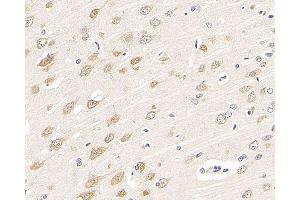 Immunohistochemistry analysis of paraffin-embedded rat brain using RBFOX3 Polyclonal Antibody at dilution of 1:300. (NeuN anticorps)
