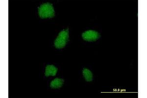 Immunofluorescence of purified MaxPab antibody to SMA4 on HeLa cell. (SMN1 anticorps  (AA 1-140))