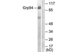 Western blot analysis of extracts from SKOV3 cells, using GRP94 Antibody. (GRP94 anticorps  (AA 754-803))