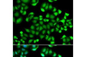Immunofluorescence analysis of A549 cells using MAPKAPK3 Polyclonal Antibody (MAPKAP Kinase 3 anticorps)