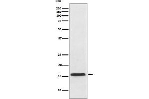 Western blot analysis of VAMP2 expression in mouse brain lysate.