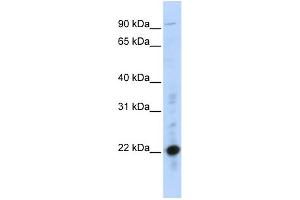 WB Suggested Anti-CRIP2 Antibody Titration:  0. (CRIP2 anticorps  (Middle Region))