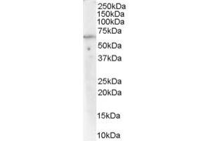 Western Blotting (WB) image for anti-ATPase, Cu++ Transporting, alpha Polypeptide (ATP7A) (Middle Region) antibody (ABIN2781761)