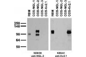 Adult rat brain membrane (RBM) and transfected cell immunoblot: extracts of RBM and COS cells transiently transfected with Myc-tagged NGL-1, NGL-2, NGL-3 or untagged Kv2.