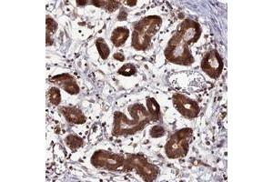 Immunohistochemical staining of human breast with C11orf10 polyclonal antibody  shows strong cytoplasmic positivity in glandular cells. (TMEM258 anticorps)