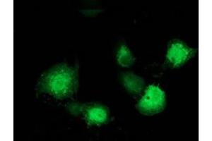 Anti-MAPRE2 mouse monoclonal antibody (ABIN2454543) immunofluorescent staining of COS7 cells transiently transfected by pCMV6-ENTRY MAPRE2 (RC200259). (MAPRE2 anticorps)
