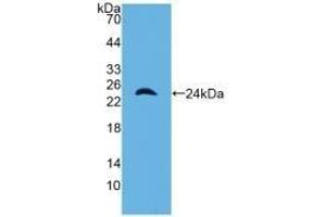Detection of Recombinant a1M, Mouse using Polyclonal Antibody to Alpha-1-Microglobulin (a1M)