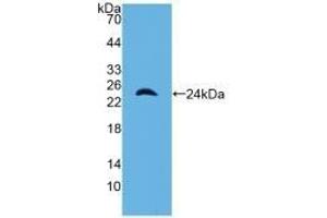 Detection of Recombinant a1M, Mouse using Polyclonal Antibody to Alpha-1-Microglobulin (a1M) (AMBP anticorps  (AA 18-202))