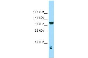 WB Suggested Anti-CACNA2D2 Antibody Titration: 1. (CACNA2D2 anticorps  (C-Term))