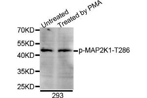 Western blot analysis of extracts of 293 cell line, using Phospho-MAP2K1-T286 antibody. (MEK1 anticorps  (pThr285))
