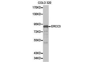 Western Blotting (WB) image for anti-DNA Repair Protein Complementing XP-B Cells (ERCC3) antibody (ABIN1872578) (ERCC3 anticorps)