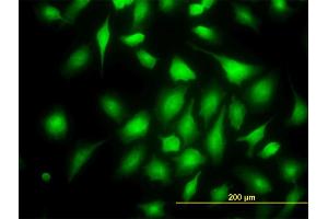 Immunofluorescence of monoclonal antibody to RAPGEF6 on HeLa cell.