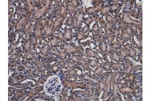 Detection of PARK7 in Mouse Kidney Tissue using Polyclonal Antibody to Parkinson Disease Protein 7 (PARK7)