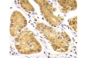 Immunohistochemistry of paraffin-embedded Human stomach using SCO2 Polyclonal Antibody at dilution of 1:100 (40x lens). (SCO2 anticorps)
