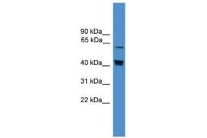 WB Suggested Anti-EIF2AK2  Antibody Titration: 0. (EIF2AK2 anticorps  (Middle Region))