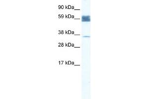 WB Suggested Anti-ZNF713 Antibody Titration:  1. (ZNF713 anticorps  (N-Term))