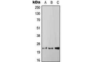 Western blot analysis of RGS4 expression in HepG2 (A), SP2/0 (B), PC12 (C) whole cell lysates. (RGS4 anticorps  (Center))