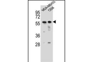 FOXD4 Antibody (Center) (ABIN656115 and ABIN2845454) western blot analysis in MDA-M,CEM cell line lysates (35 μg/lane). (FOXD4 anticorps  (AA 182-210))