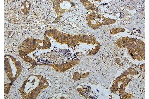 IHC analysis of RET using anti-RET antibody (ABIN6719502). (Ret Proto-Oncogene anticorps  (AA 29-304))