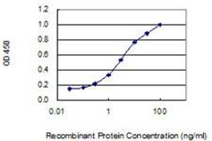 Detection limit for recombinant GST tagged WDR62 is 0. (WDR62 anticorps  (AA 1-630))
