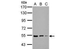 Image no. 2 for anti-Kelch Repeat and BTB (POZ) Domain Containing 4 (KBTBD4) (AA 287-518) antibody (ABIN1501896) (KBTBD4 anticorps  (AA 287-518))