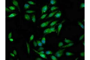 Immunofluorescence staining of Hela cells with ABIN7166993 at 1:100, counter-stained with DAPI.