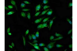 Immunofluorescence staining of Hela cells with ABIN7166993 at 1:100, counter-stained with DAPI. (RAB3GAP1 anticorps  (Catalytic Subunit))