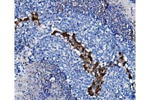 IHC analysis of CD38 using anti-CD38 antibody (ABIN7602815). (CD38 anticorps  (C-Term))