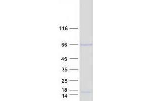 Validation with Western Blot