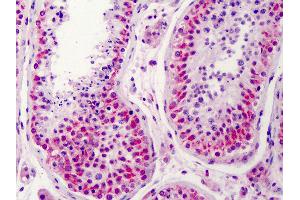 Anti-NEK2 antibody IHC of human testis. (NEK2 anticorps  (AA 287-299))