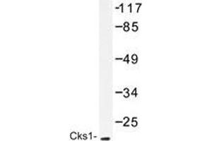 Western blot analysis of Cks1 antibody in extracts from Jurkat cells treated with serum 20% 15'. (CKS1 anticorps)
