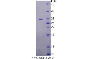 Image no. 1 for Kallikrein 2 (KLK2) (AA 19-261) protein (His tag) (ABIN4989724) (Kallikrein 2 Protein (KLK2) (AA 19-261) (His tag))