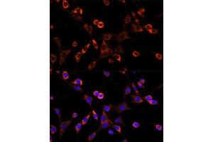 Immunofluorescence analysis of NIH/3T3 cells using OCLN antibody. (Occludin anticorps  (AA 263-522))