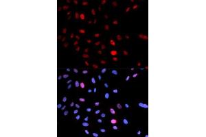 Immunofluorescence analysis of U2OS cells using Phospho-SMC1A-S957 antibody. (SMC1A anticorps  (pSer957))