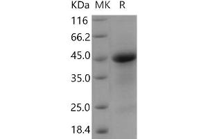 Western Blotting (WB) image for R-Spondin 1 (RSPO1) (Active) protein (His tag) (ABIN7320321) (RSPO1 Protein (His tag))