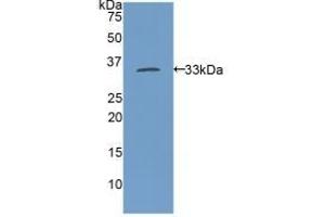 Detection of Recombinant MYH11, Rat using Polyclonal Antibody to Myosin Heavy Chain 11, Smooth Muscle (MYH11)