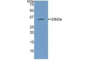 Detection of Recombinant MYH11, Rat using Polyclonal Antibody to Myosin Heavy Chain 11, Smooth Muscle (MYH11) (MYH11 anticorps  (AA 211-482))
