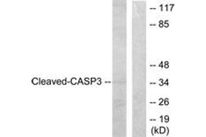 Western blot analysis of extracts from HeLa cells, treated with Etoposide 25uM 60', using Caspase 3 (Cleaved-Asp175) Antibody. (Caspase 3 anticorps  (Cleaved-Asp175))