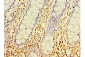 Immunohistochemistry of paraffin-embedded human colon tissue using ABIN7170540 at dilution of 1:100 (Spermidine Synthase anticorps  (AA 1-302))