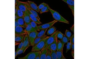 Immunofluorescence Analysis of HeLa cells labeling Fascin with Fascin-1 Mouse Monoclonal Antibody (FSCN1/418) -CF640 (Green).