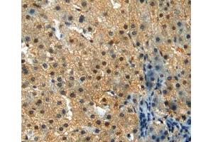 Used in DAB staining on fromalin fixed paraffin- embedded liver tissue